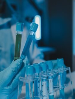 Laboratory Testing