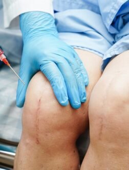 Platelet-Rich Plasma (PRP)