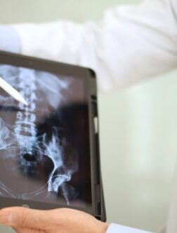 Radiological Assessments