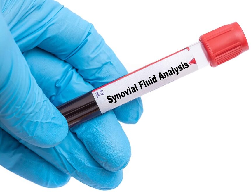 Synovial Fluid Analysis