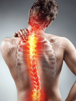 osteoporosis